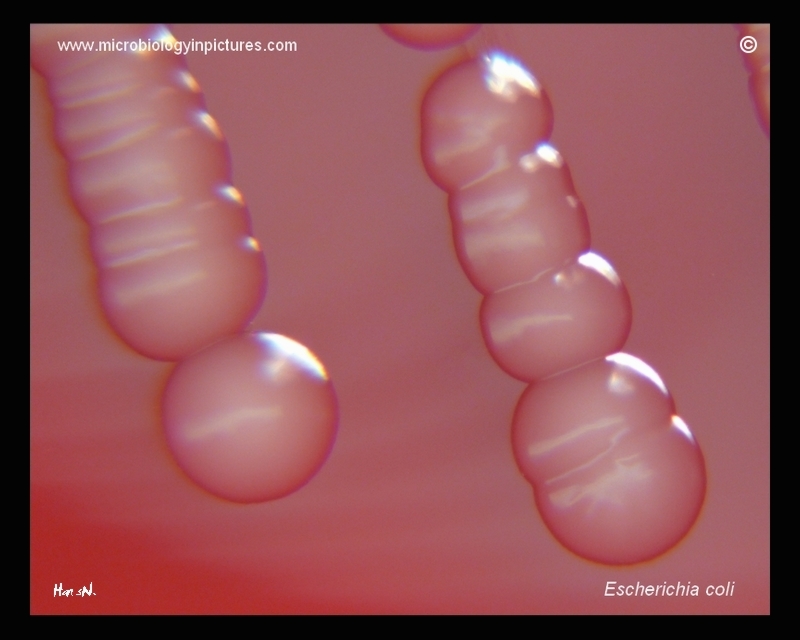E.coli